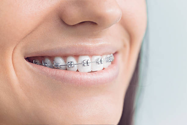 Best Root Canal Treatment  in Bude, MS